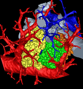 Image: Lung maze modeled in 3D (Photo courtesy of Dragos Vasilescu, University of Iowa and the University of British Columbia).